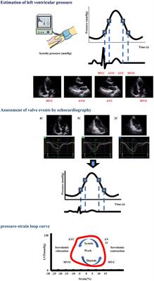 Evaluation of the effect of kidney transplantation on left ventricular myocardial work by noninvasive pressure-strain loops